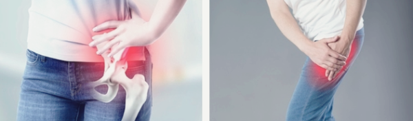 고관절 통증 원인 증상 수술방법