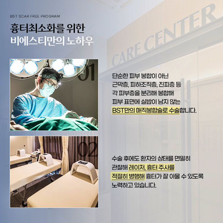 흉터 최소화를 위한 비에스티성형외과만의 노하우 

단순한 피부 봉합이 아닌 근막층, 피하조직층, 진피층 등 각 피부층을 분리해서 봉합해 피부 표면에 실밥이 남지 않는 BST만의 매직봉합법으로 수술합니다.