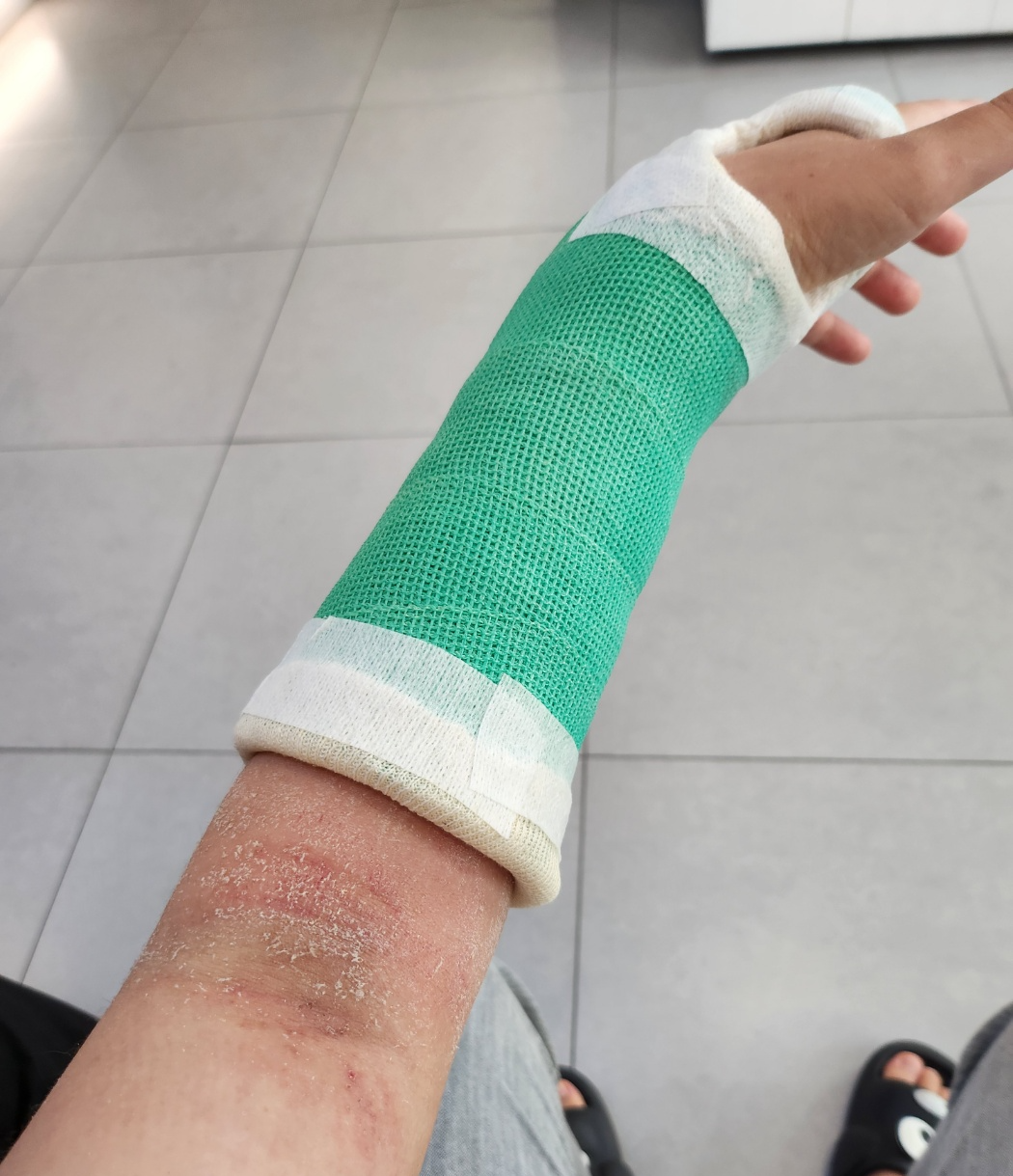 손목부음 뼈 부러졌을때