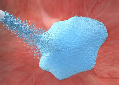 넥스트바이오메디컬 공모주 청약
