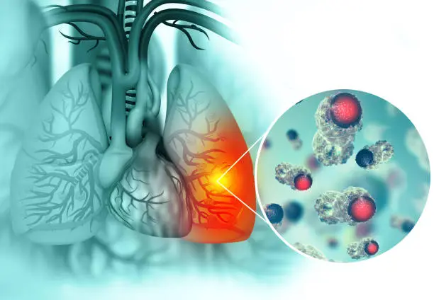 성인 홍역과 소아 홍역의 차이점과 위험성 비교