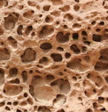 골다공증 치료방법 진단기준 예방법