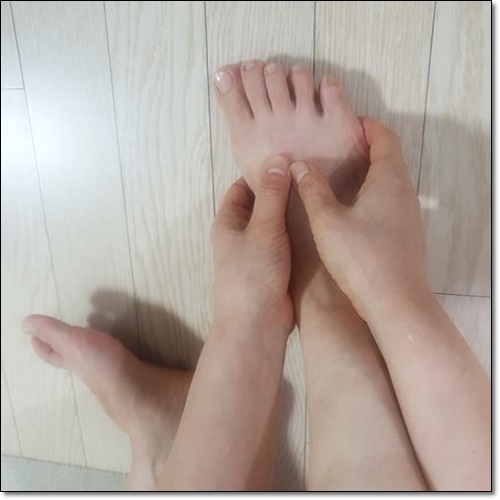 지간신경종 증상