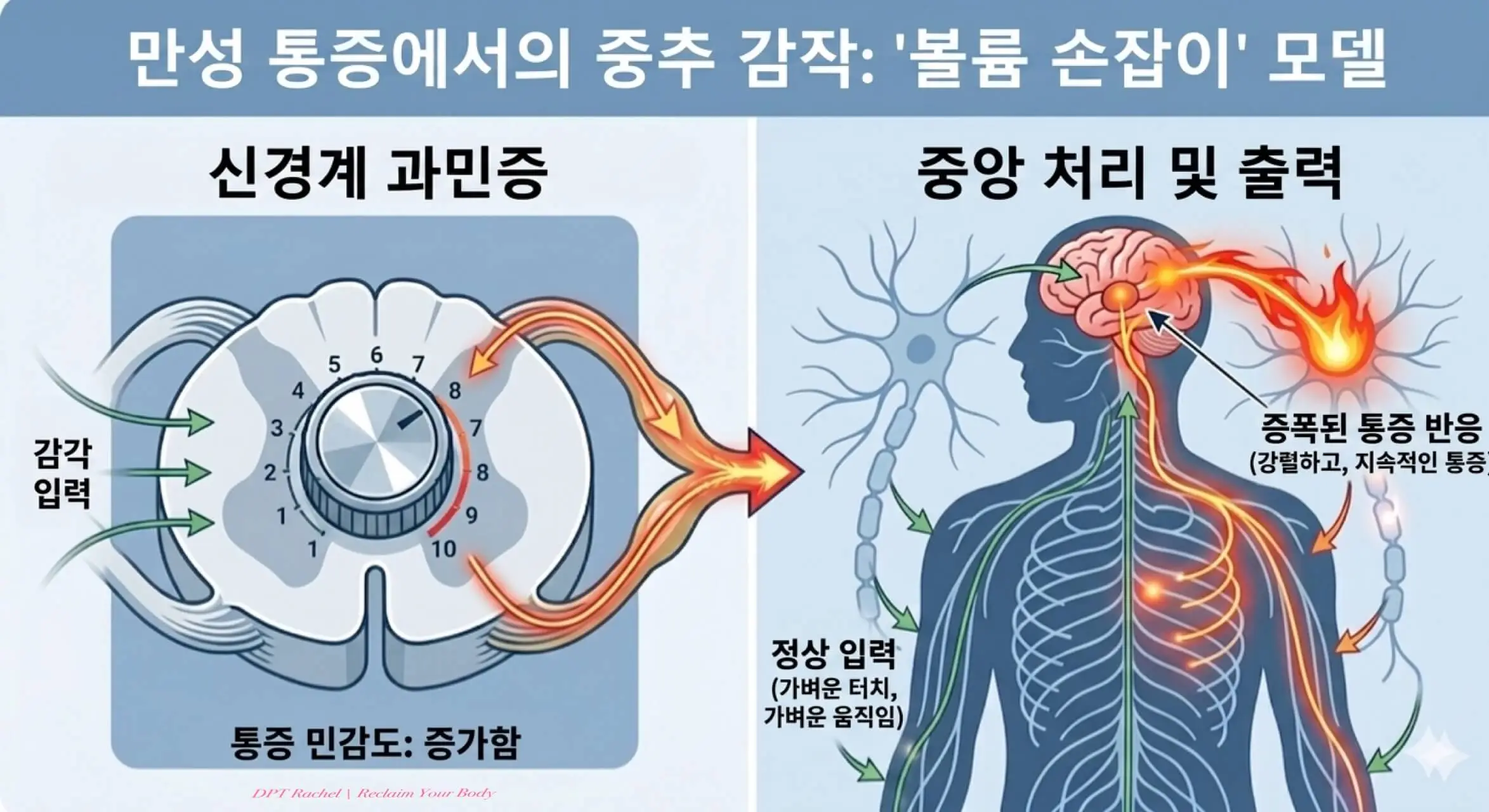 중추감작으로 인해 작은 자극도 크게 통증으로 증폭되는 신경계 과민화 설명 그림