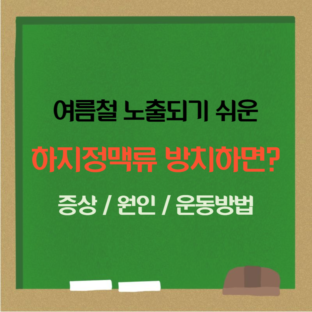 하지정맥류 방치하면? 증상 원인 운동방법
