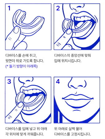 덴탈스 인비저 사용방법
