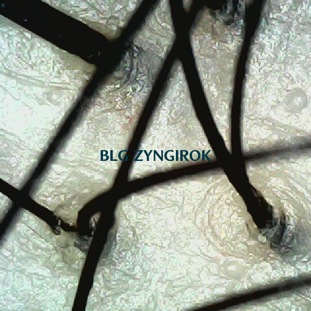 탈모 극복 프로젝트 - 뒷머리 두피 모습이다.