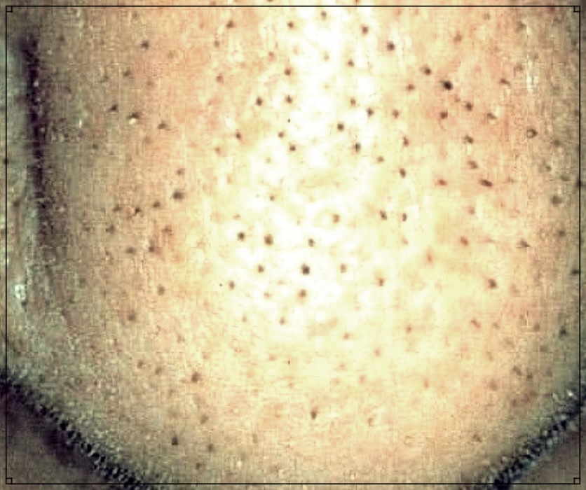 소극성속모증: 원인, 증상, 치료법 완벽 가이드