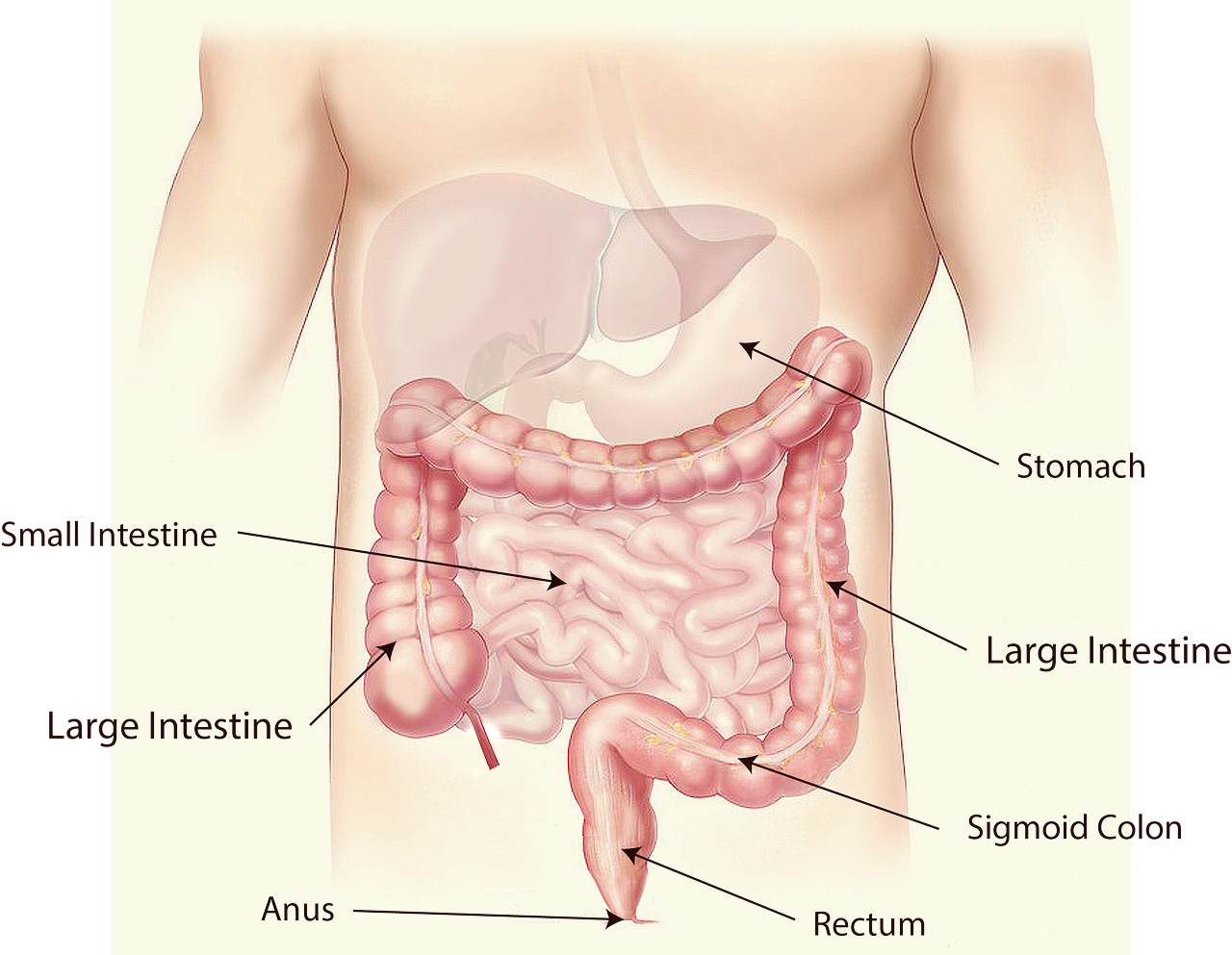 점액변이란, 점액변 원인