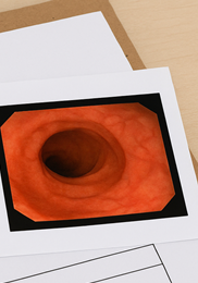 과민성 대장증후군 증상