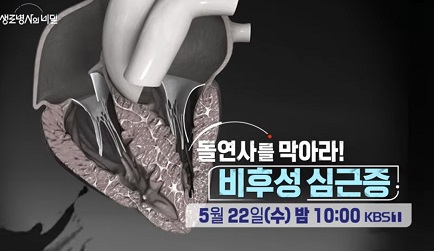 돌연사-비후성심근증