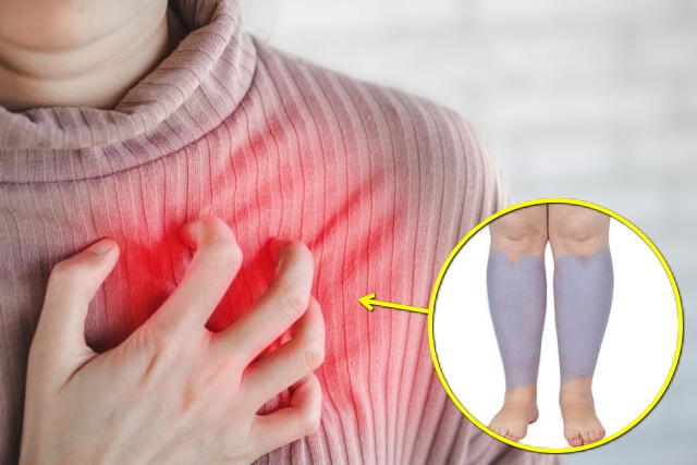 심장이 안좋을때 증상 심부전 부종 붓기 종아리가 붓는 이유,건강 팁줌 매일꿀정보