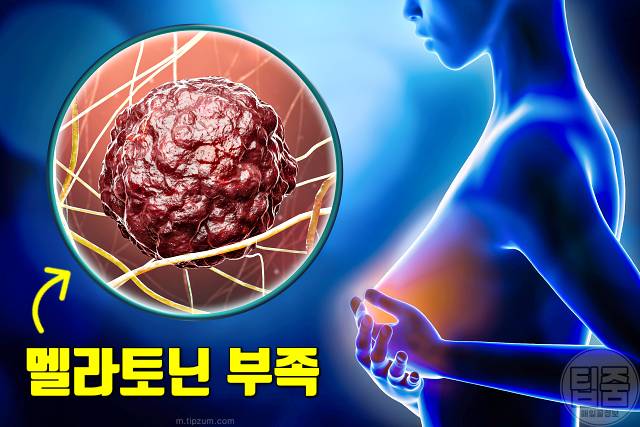 멜라토닌 부족 증상 노화 유방암 난소암 면역력 심장