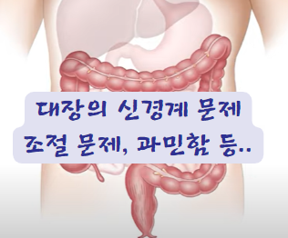 과민성대장증후군 치료 1 스트레스
