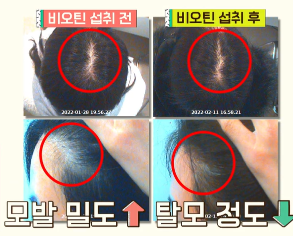 비오틴 효능