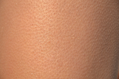피부