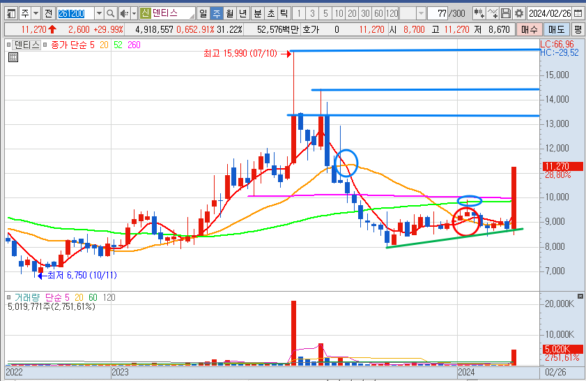 덴티스 주봉 차트 전망 분석 (24.2.28)