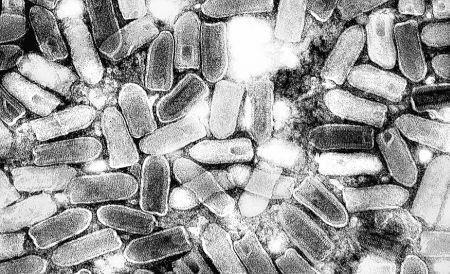 에페메로바이러스