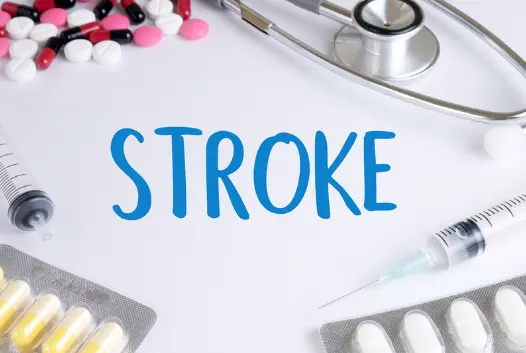 뇌경색 초기증상, 원인 및 치료 방법