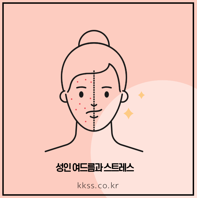 성인 여드름과 스트레스