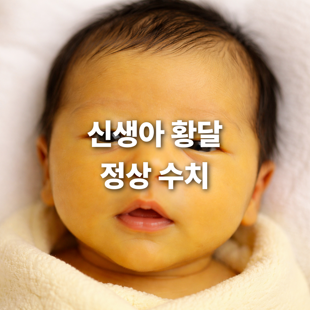 신생아 황달 수치, 이 정도면 병원 가야 합니다⚠️