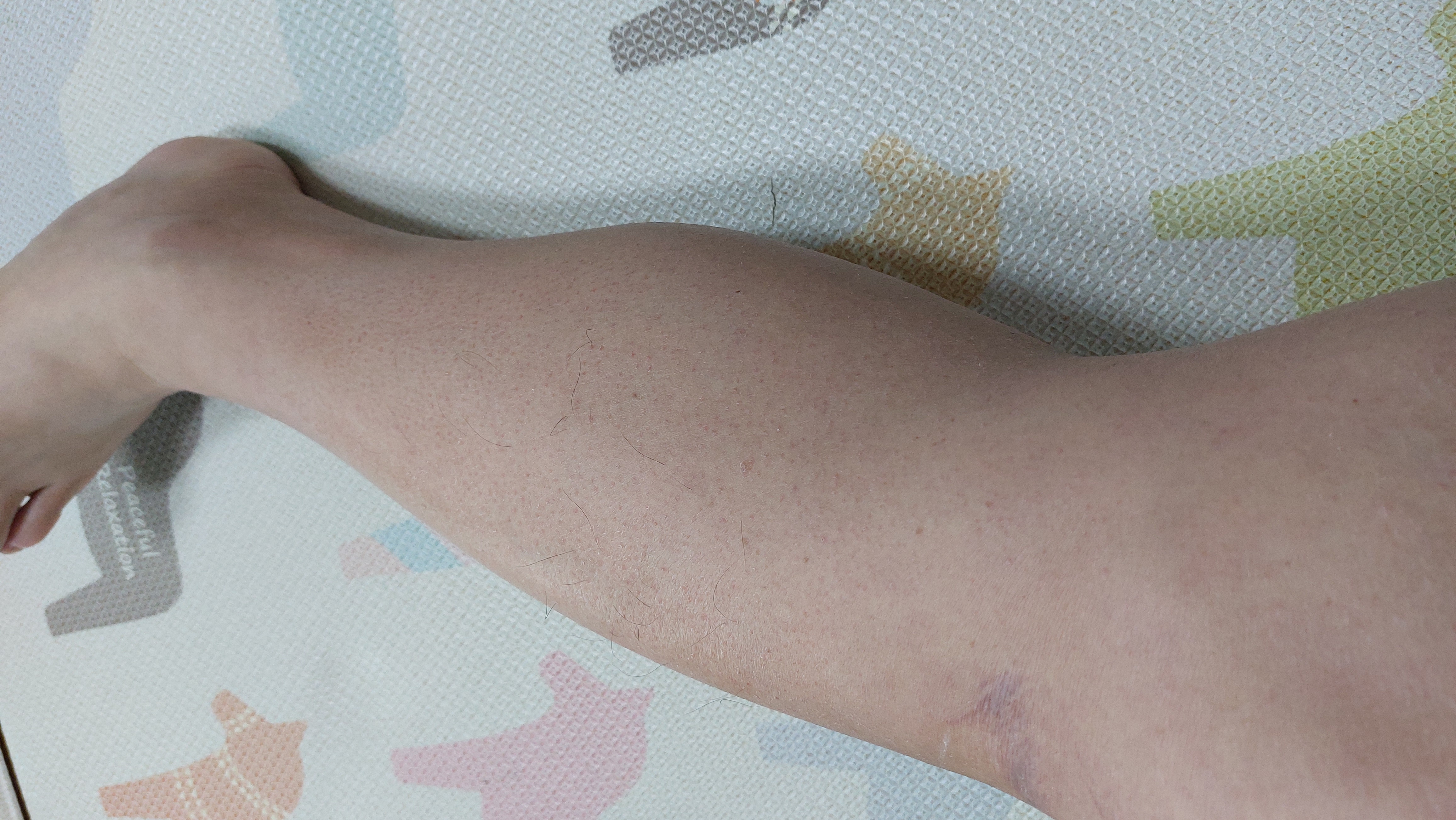 두꺼운 나의 종아리