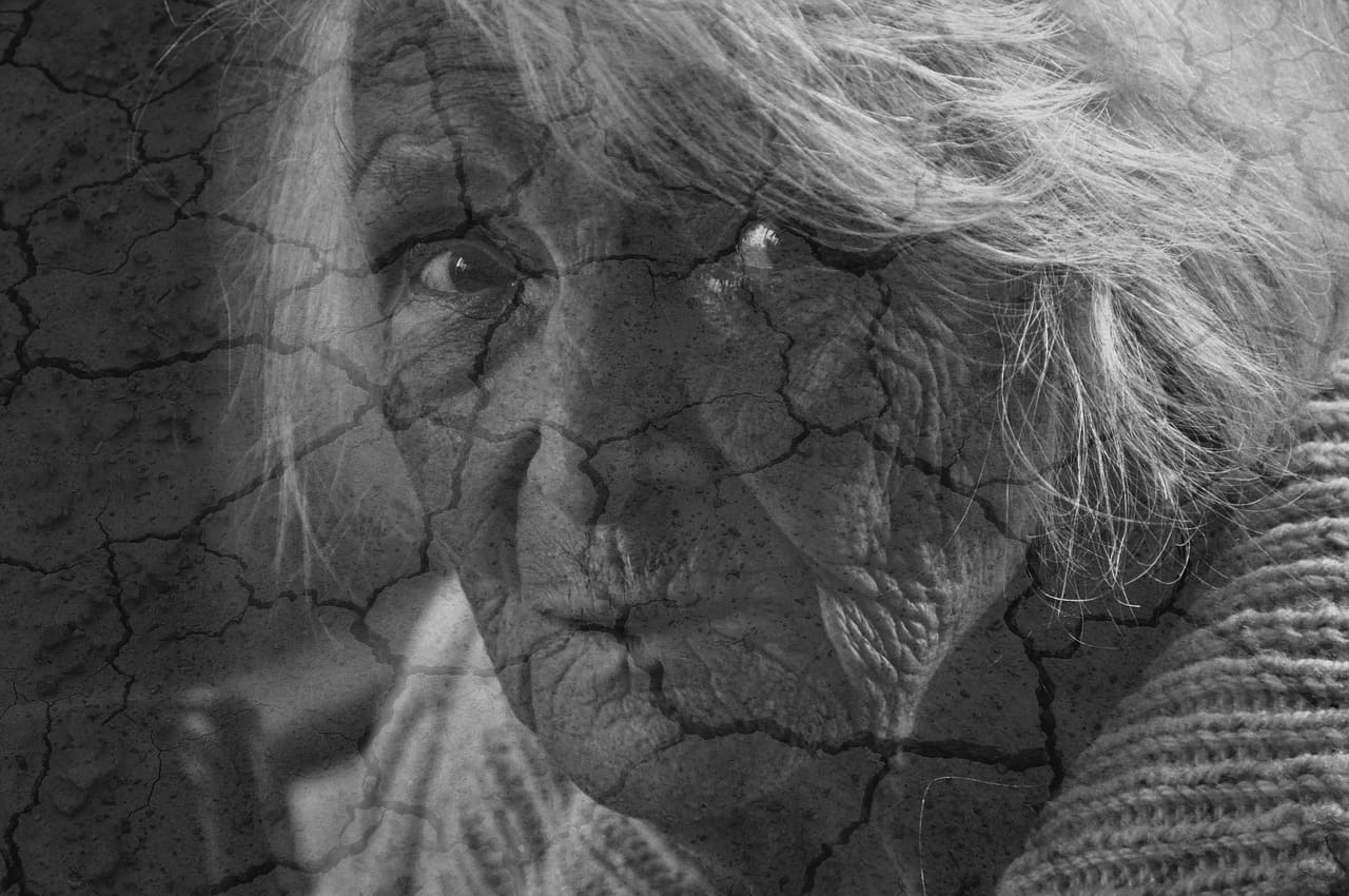 피부가 논바닥처럼 갈라진 노인