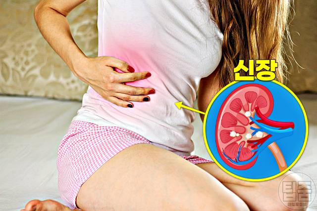 신장에 나쁜 영양제 약 비타민 과다복용 하루권장량