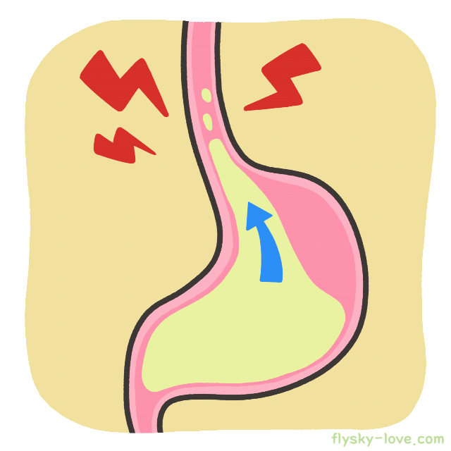 역류성 식도염 증상