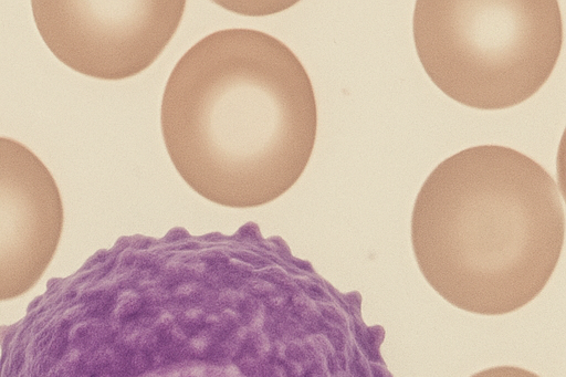 백혈병·림프종·골수종의 종류와 원인, 초기증상 총정리
