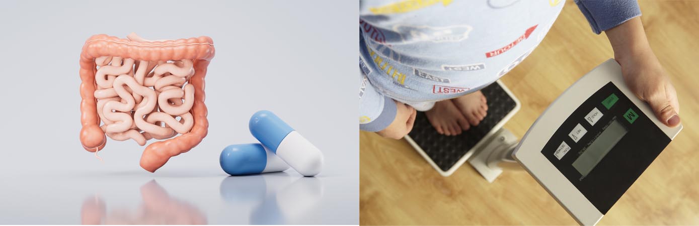 장내 환경이 체중을 좌우한다