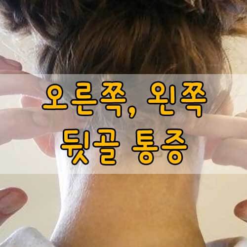 오른쪽 뒷골 통증&#44; 왼쪽 뒷골 통증&#44; 뒷머리가 찌릿찌릿&#44; 후두신경통 원인과 치료방법