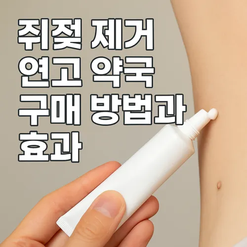 쥐젖 제거 연고 약국 구매 방법과 효과 썸네일