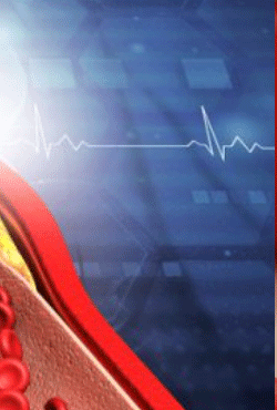 혈관그림-그래프