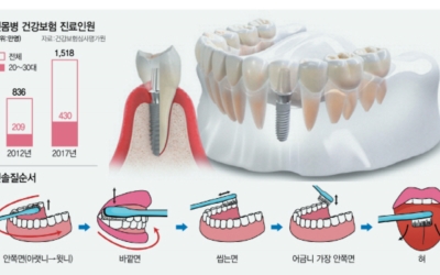 잇몸 사진