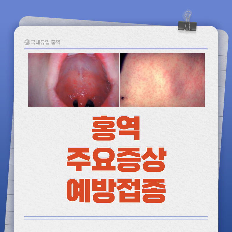 홍역 증상 (홍역과 수두 차이점)