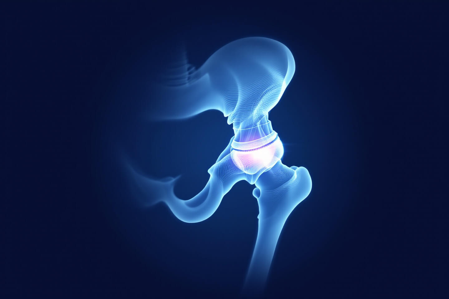 고관절 사진입니다.