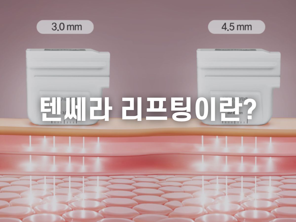 텐쎄라란