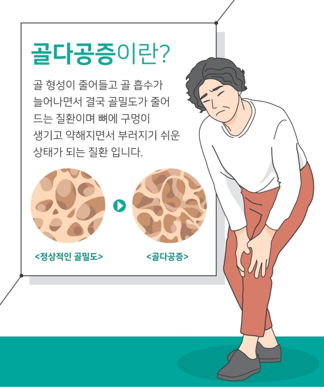 여성질환: 골다공증- 증상, 원인, 겸사 방법, 치료방법.