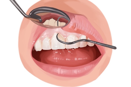 스케일링-보험-미적용