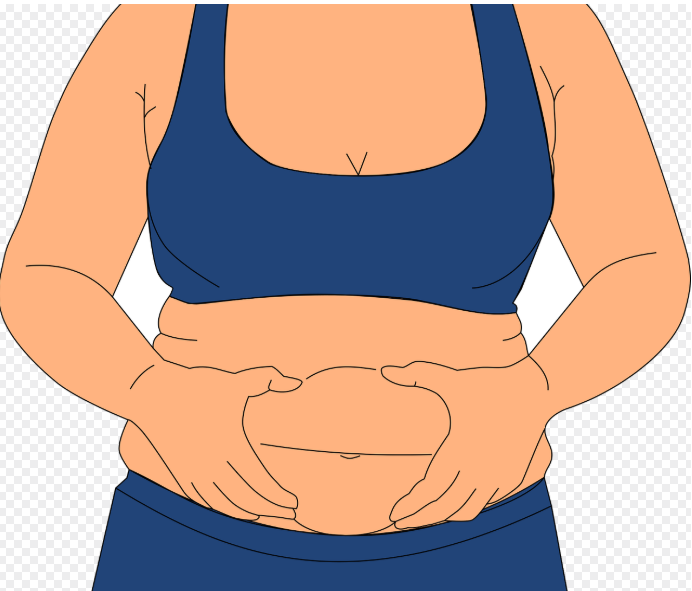 복부비만1