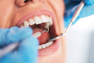 입냄새 원인 치아 위생