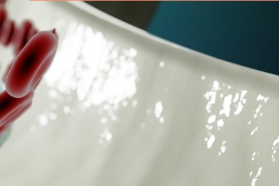 경동맥 협착증 증상