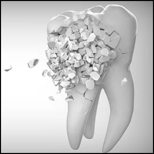 부서지는 어금니