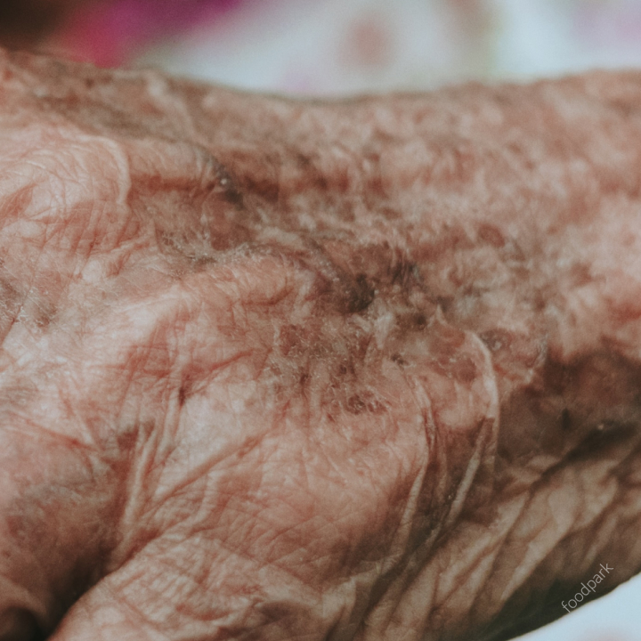 피부 노화 원인