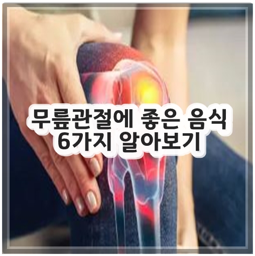 무릎관절에 좋은 음식 6가지 알아보기