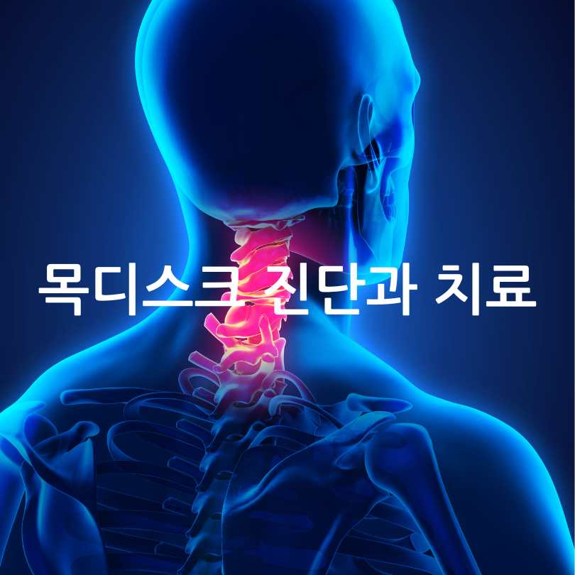 목디스크 증상