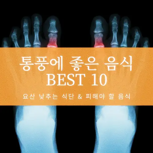 통풍에 좋은 음식 BEST 10