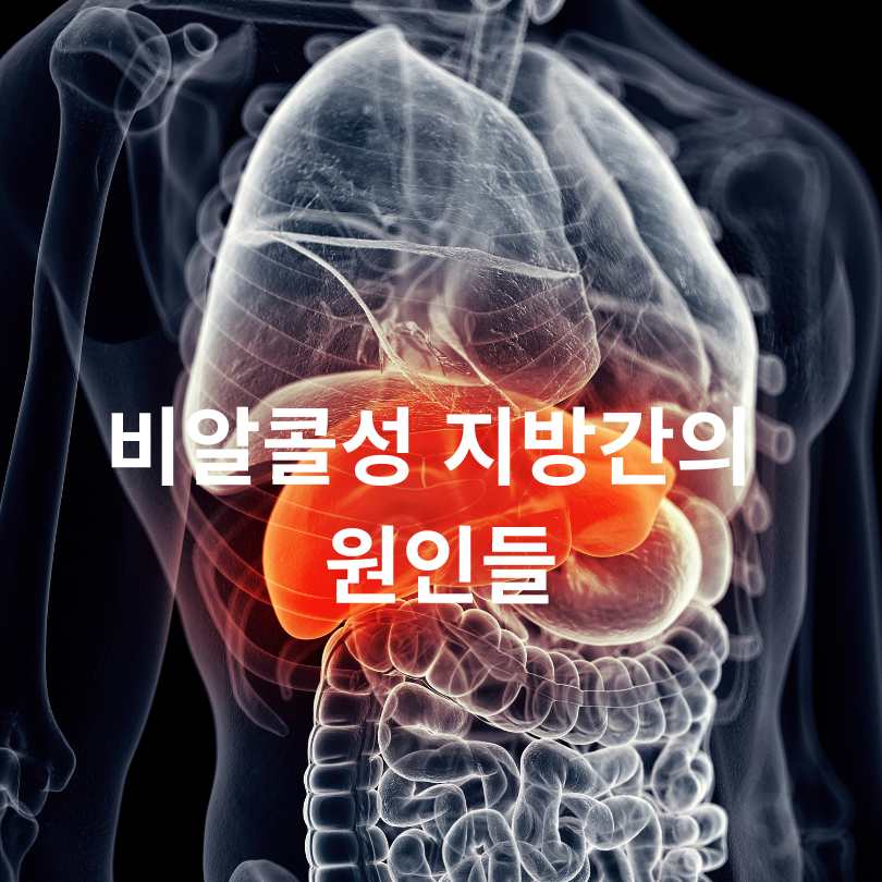 비알콜성 지방간 원인과 간수치 상승의 관계