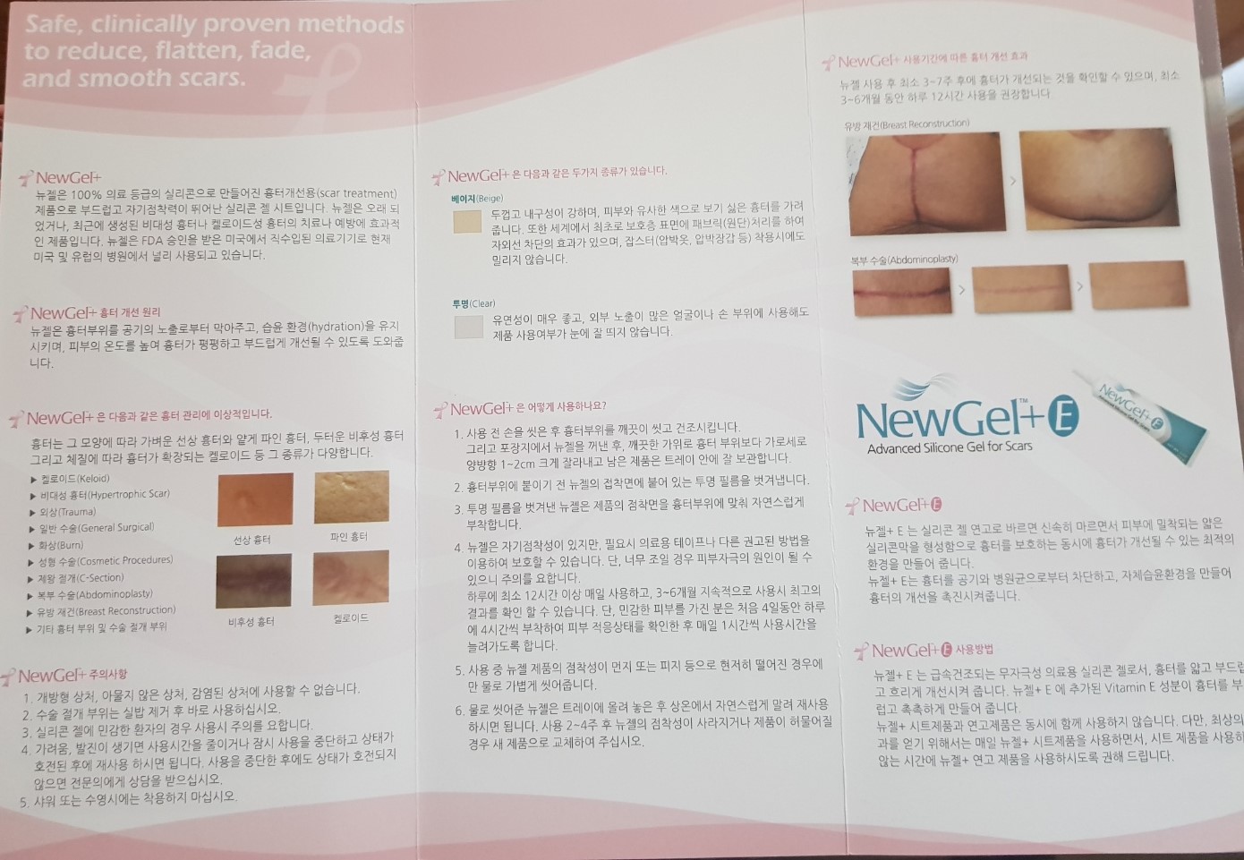 흉터연고 뉴젤